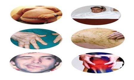 MD Kayachikitsa